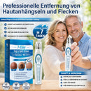 Fortschrittlicher Roller-Ball-Stift zur Entfernung von Muttermalen und Warzen