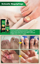 Ingwer-Nagelpflegelösung