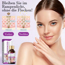 Fortschrittliches Anti-Pigmentierungsserum