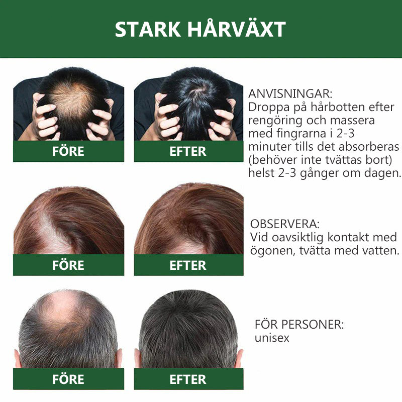 7 dagars växtbaserat hårtillväxtserum
