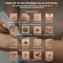 Fortschrittlicher Roller-Ball-Stift zur Entfernung von Muttermalen und Warzen