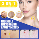 Kit zur Entfernung von Hautmarkierungen