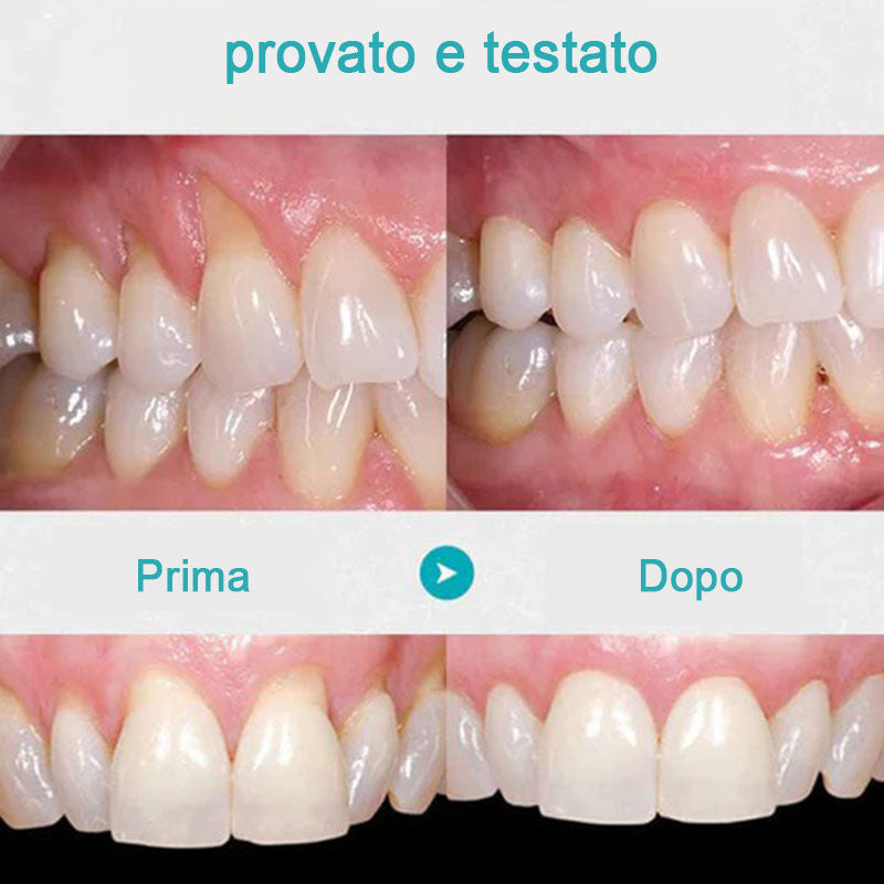 Gel per la riparazione dei denti (acquista 1 prendi 1 gratis)