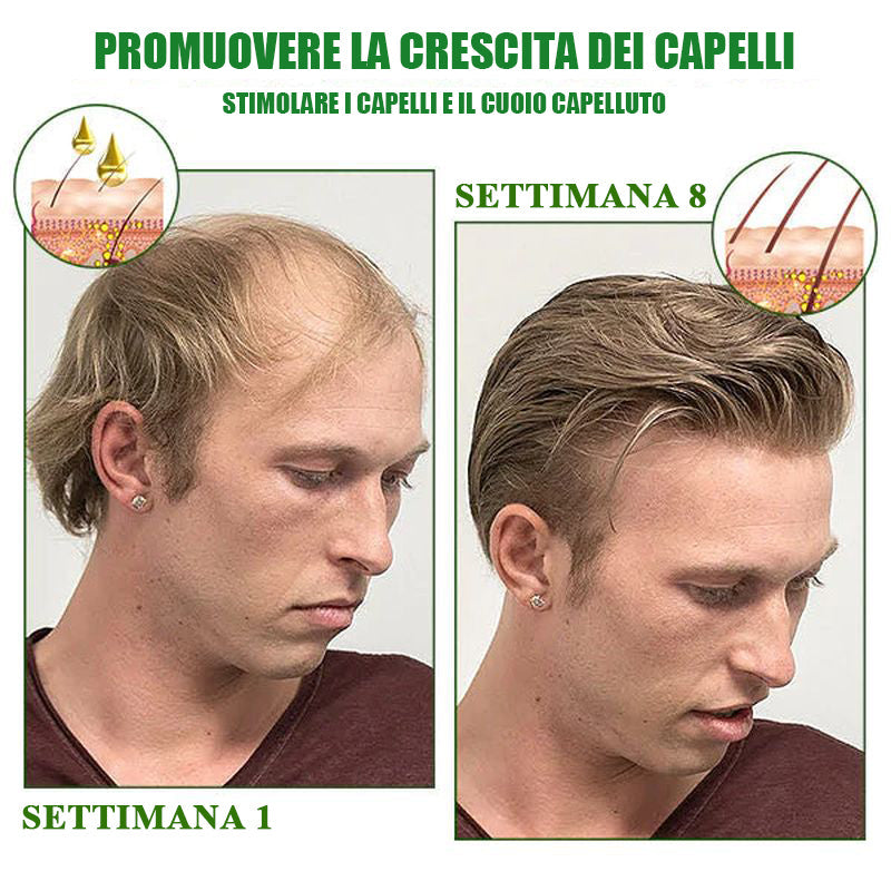 Spray per la crescita dei capelli al ginseng rosso