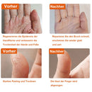 Anti-Cracking-Wintergel